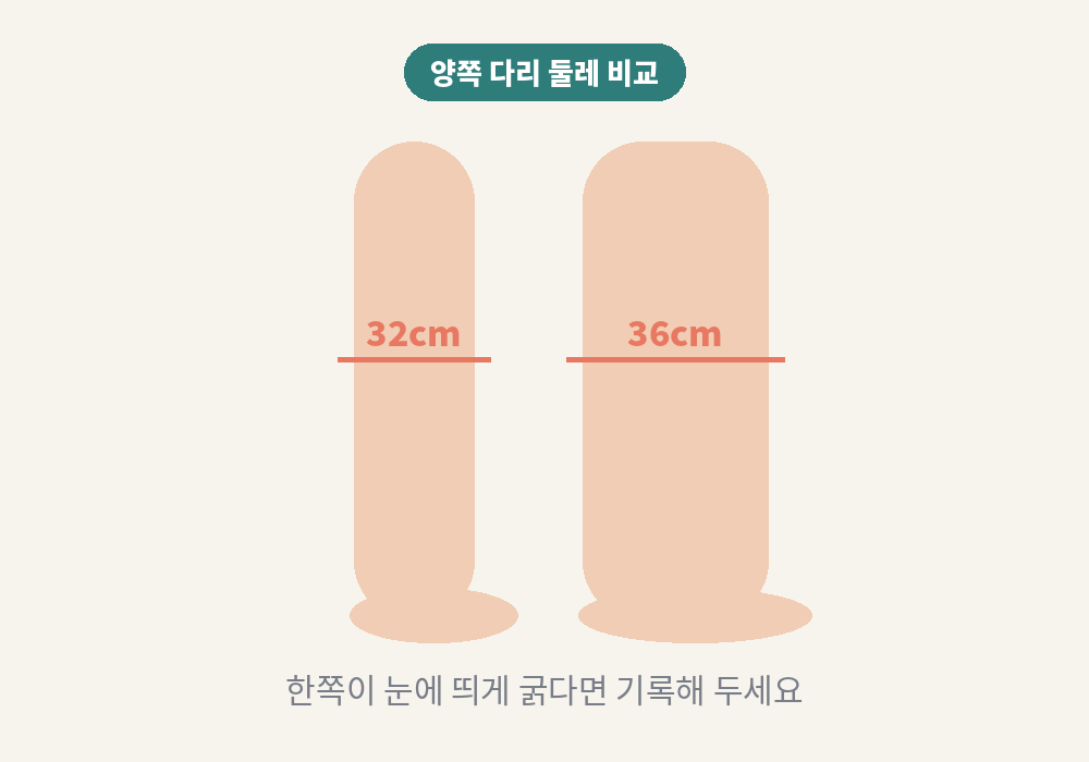 다리 림프부종 확인을 위한 양쪽 다리 둘레 비교
