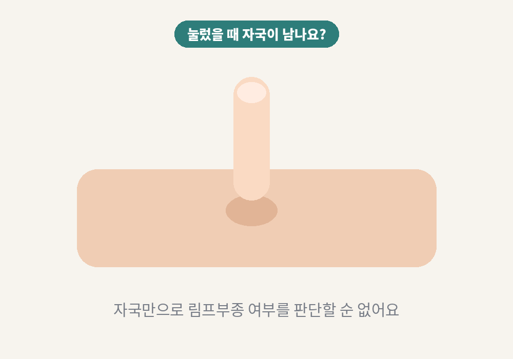 부은 다리를 손가락으로 눌러 자국을 확인하는 모습