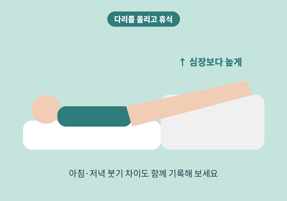 다리 붓기 완화를 위해 다리를 심장보다 높게 올리고 휴식