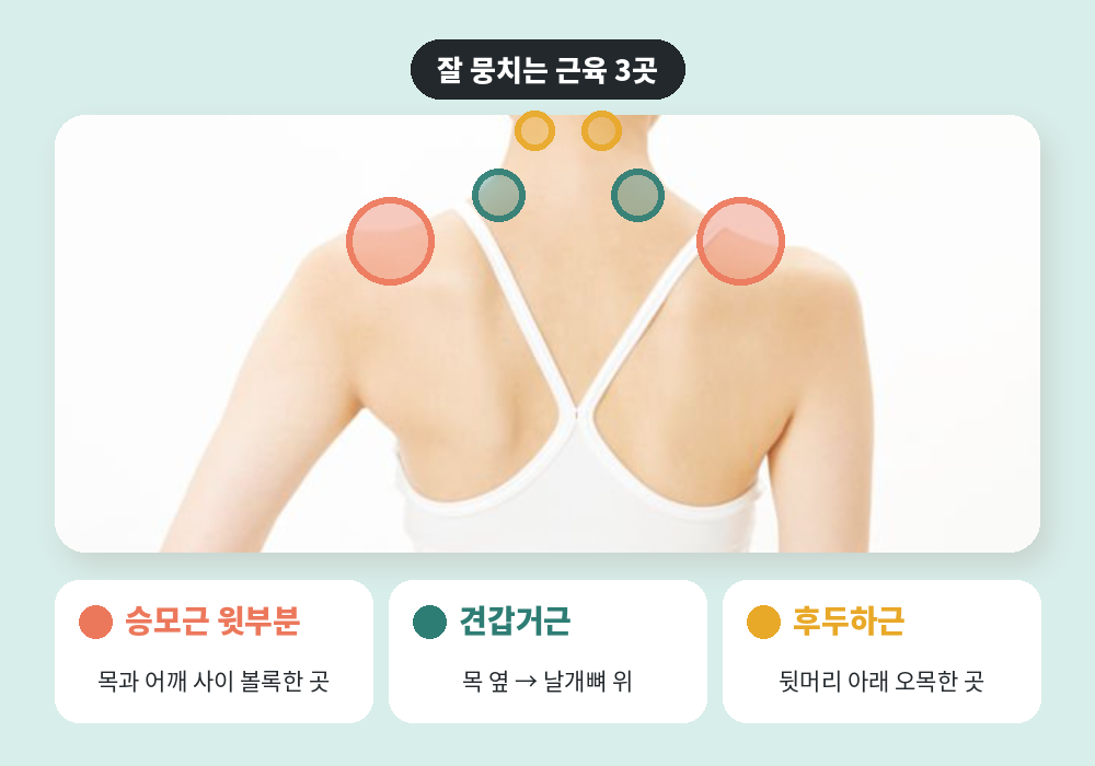 목 어깨 마사지 시 잘 뭉치는 승모근 견갑거근 후두하근 위치