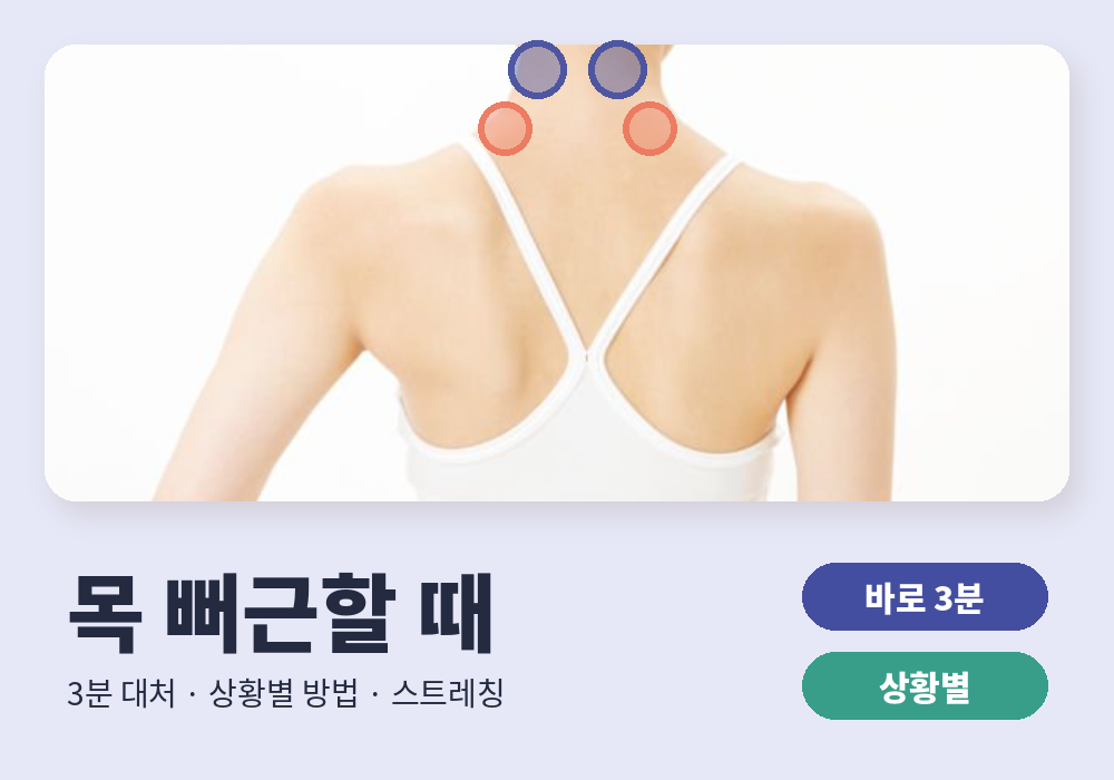 목 뻐근할 때 대처법 상황별 정리 대표 이미지
