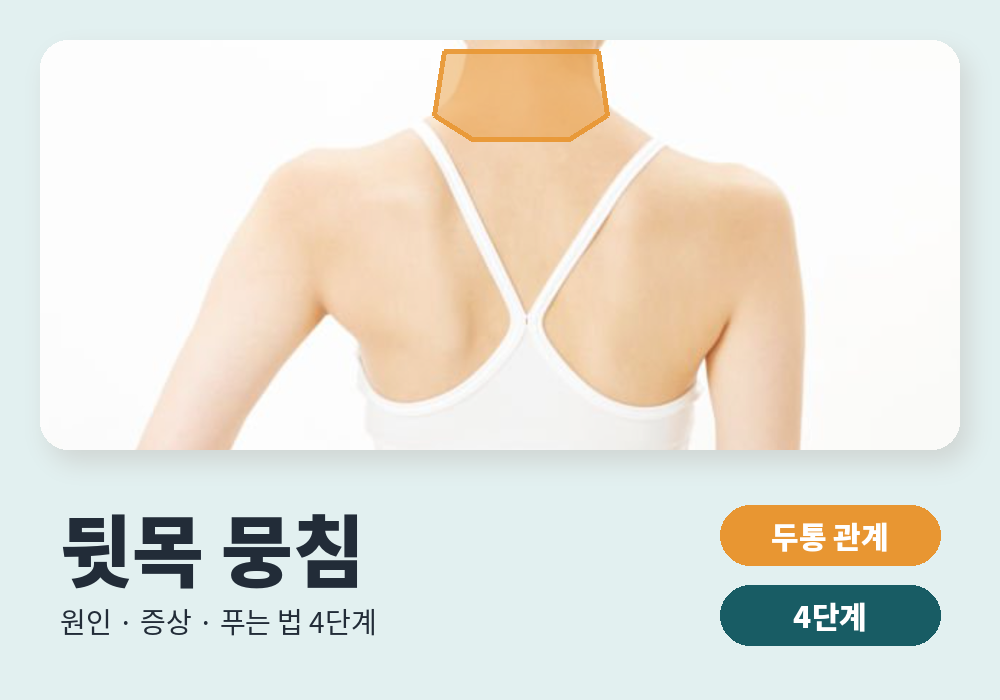 뒷목 뭉침 원인과 푸는 법 대표 이미지
