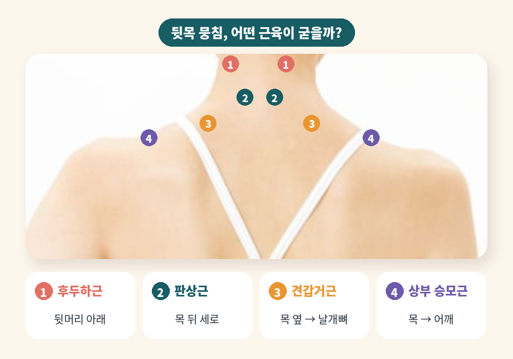 뒷목 뭉침이 생기는 후두하근 판상근 견갑거근 승모근 위치