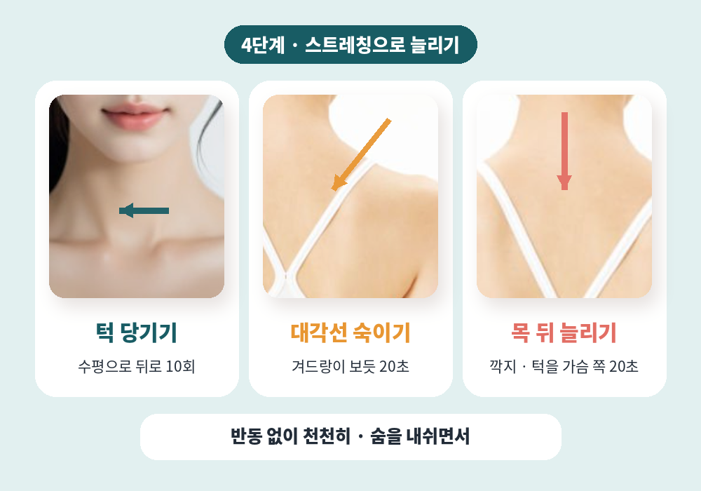 뒷목 뭉침 푸는 법 4단계 스트레칭 턱 당기기 대각선 숙이기 깍지 목 늘리기