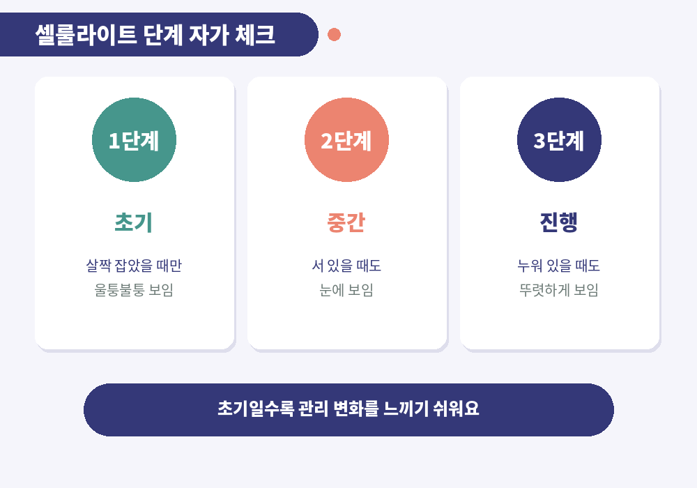 셀룰라이트 단계 자가 체크 꼬집기 서 있을 때 누웠을 때
